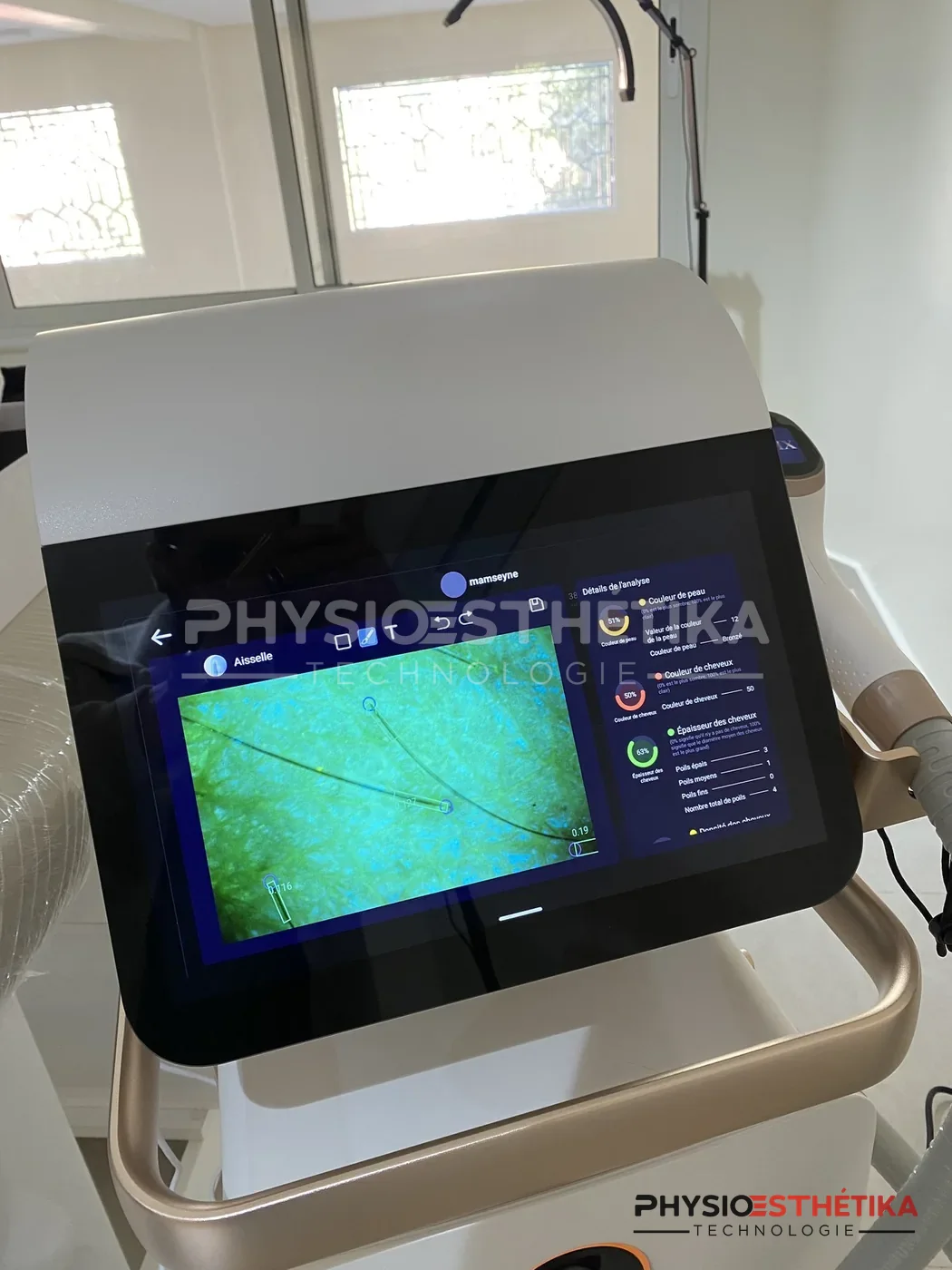 Epilase Ice Titanium